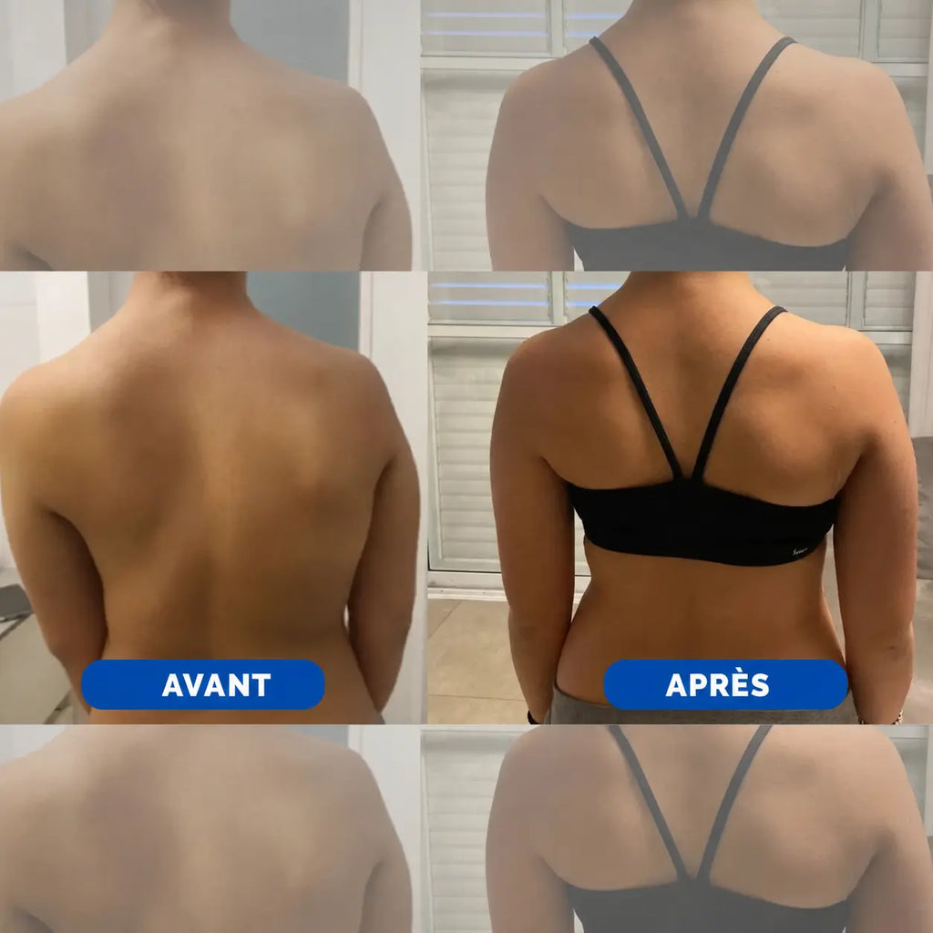 PostureFlex – Correcteur de Posture Instantané