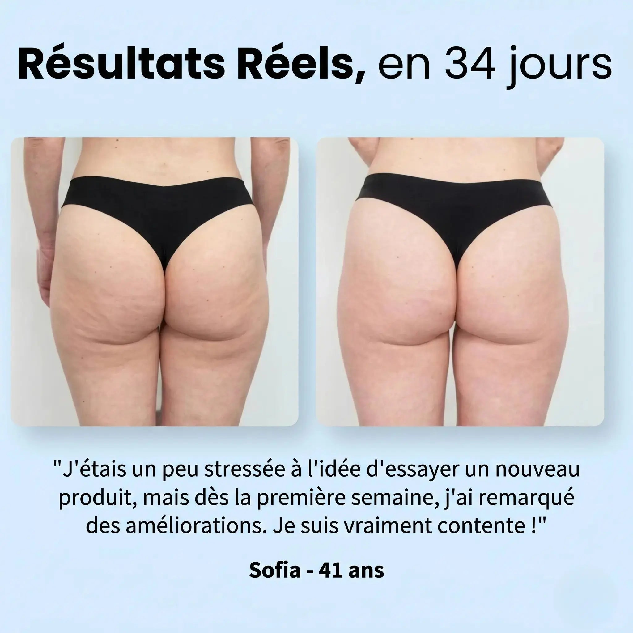 Semeryn™ SculptWave - Thérapie anti-cellulite