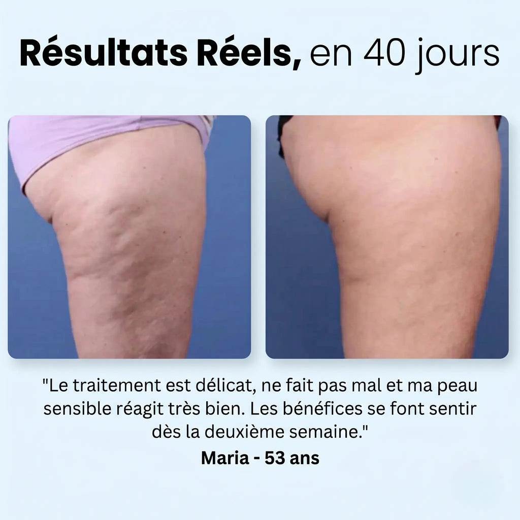 Semeryn™ SculptWave - Thérapie anti-cellulite