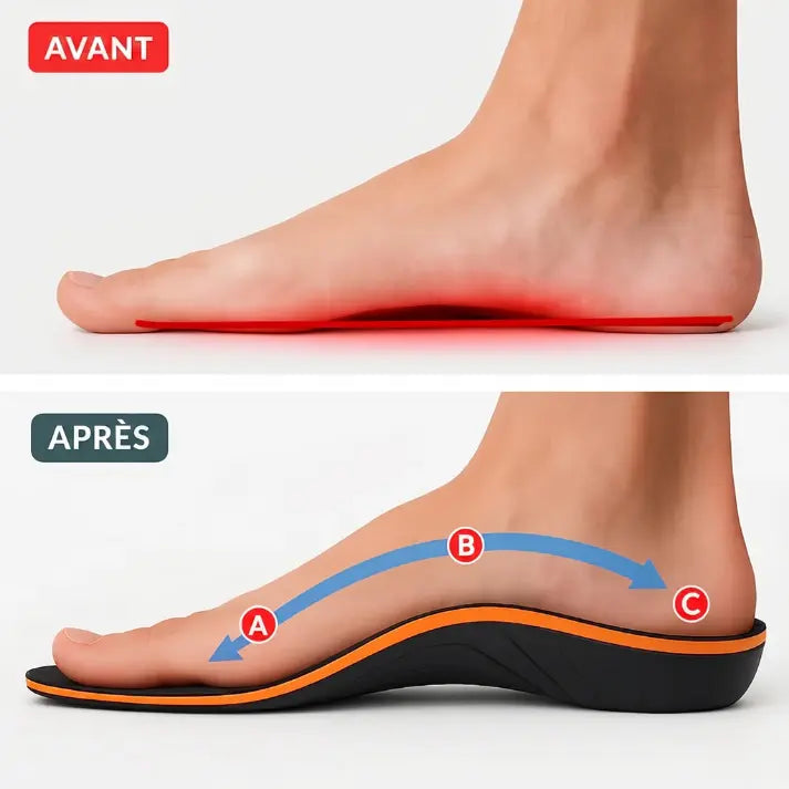 Semeryn™ - Semelles orthopédiques professionnelles